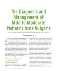 The Diagnosis and Management of Mild to Moderate Pediatric Acne ...
