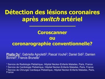 DÃ©tection des lÃ©sions coronaires aprÃ¨s switch artÃ©riel