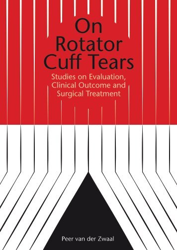 On Rotator Cuff Tears - Medisch Centrum Haaglanden