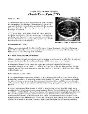 Choroid Plexus Cysts