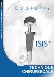 ISIS Technique opÃ©ratoire - Biotech ortho