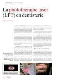 La photothÃ©rapie laser (LPT) en dentisterie