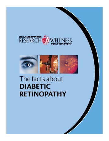 The facts about diabetic retinopathy - Diabetes Research and ...
