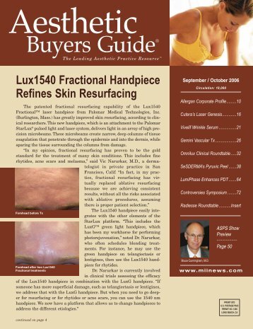 Lux 1540 Fractional Handpiece Refines Skin Resurfacing - Urogyn.org