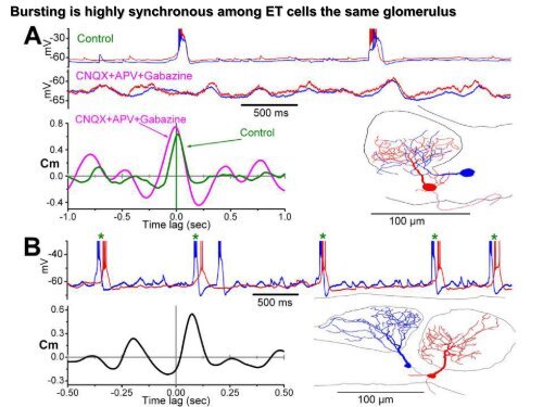 Detecting electrophysiological events - Abdallah HAYAR