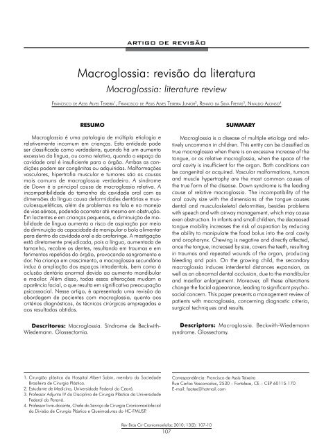 Macroglossia: revisÃ£o da literatura - ABCCMF