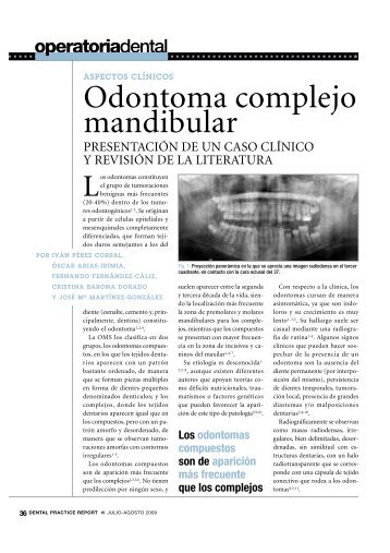 Odontoma complejo mandibular