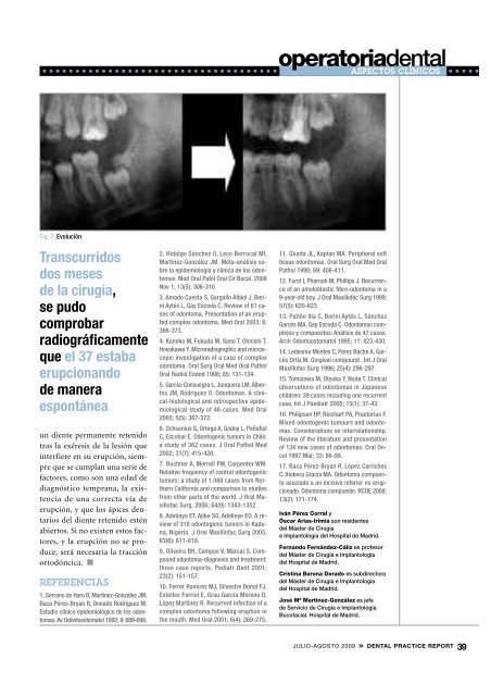 Odontoma complejo mandibular