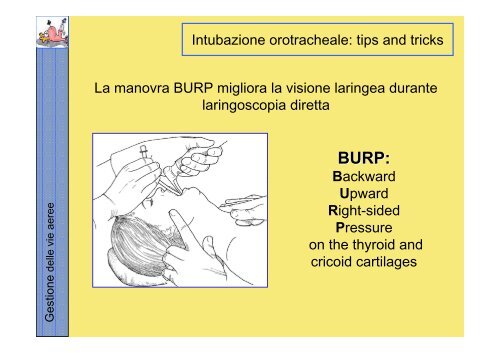 La gestione delle vie aeree PDF - Rossoemergenza