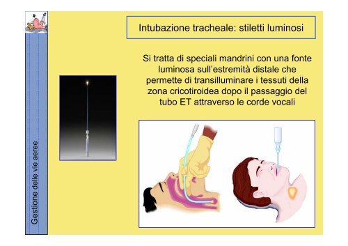 La gestione delle vie aeree PDF - Rossoemergenza