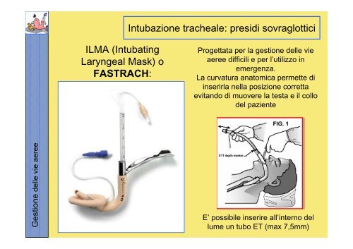 La gestione delle vie aeree PDF - Rossoemergenza