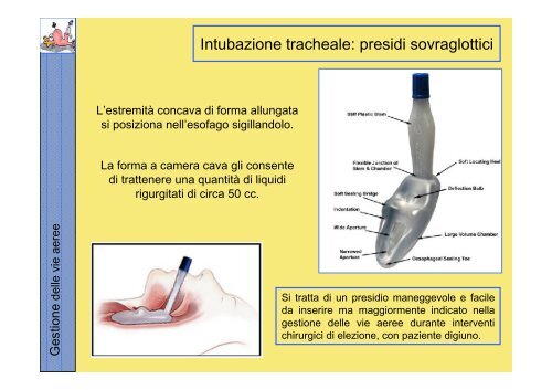 La gestione delle vie aeree PDF - Rossoemergenza