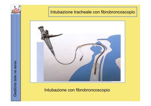 La gestione delle vie aeree PDF - Rossoemergenza