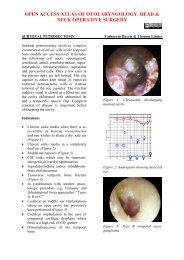 Subtotal petrosectomy - Vula - University of Cape Town