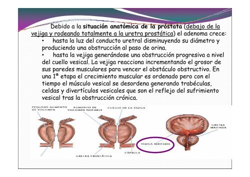 calculo erizo.pdf