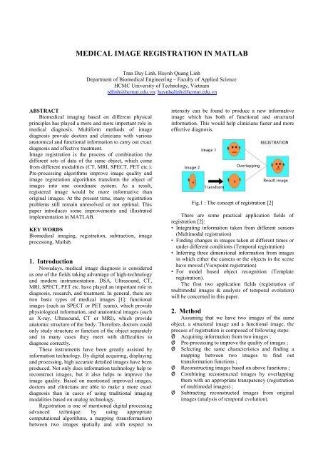 Medical Image Registration in Matlab - ResearchGate