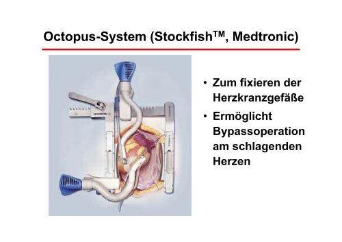 Operationstechniken - Prof. Wendt