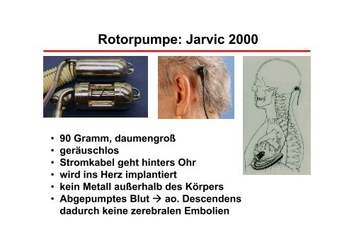 Operationstechniken - Prof. Wendt