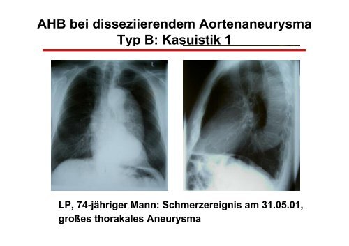 Operationstechniken - Prof. Wendt