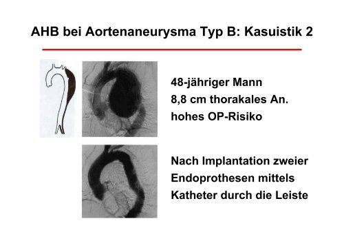 Operationstechniken - Prof. Wendt