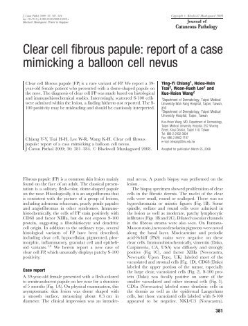 Clear cell fibrous papule: report of a case mimicking a balloon cell ...