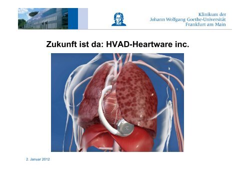 Herzinsuffizienz, VAD, Herztransplantation - FINeST
