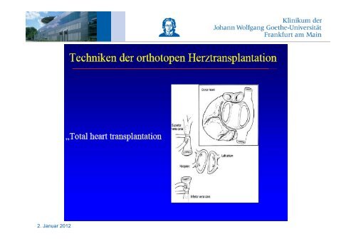 Herzinsuffizienz, VAD, Herztransplantation - FINeST