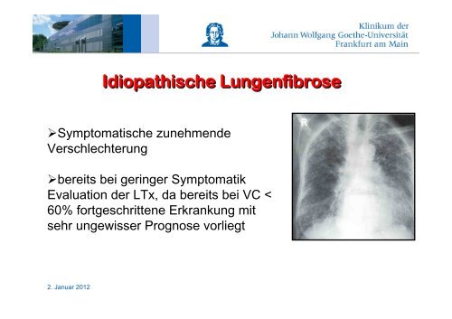 Herzinsuffizienz, VAD, Herztransplantation - FINeST