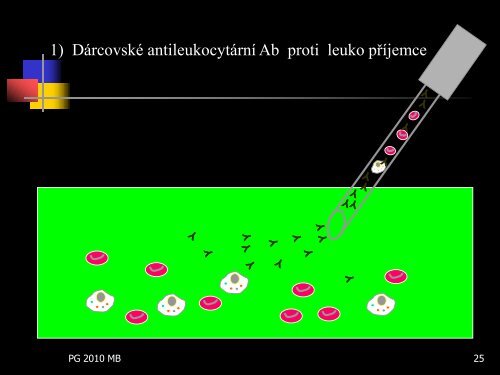 TRALI u ventilovanÃ©ho pacienta â vÃ½skyt, dg., terapie a prevence