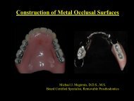 Construction of Metal Occlusal Surfaces - ProSites