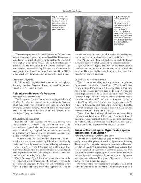 Cervical Spine Trauma: Pearls and Pitfalls