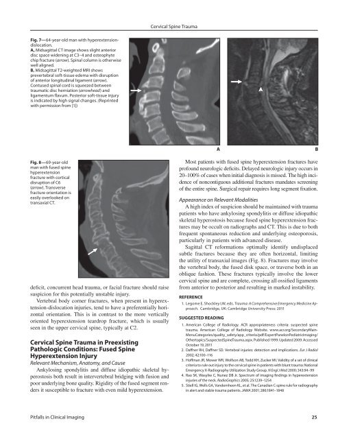 Cervical Spine Trauma: Pearls and Pitfalls