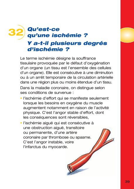 Maladie Coronaire et Infarctus Du Myocarde (IDM) - PrÃ©vention des ...