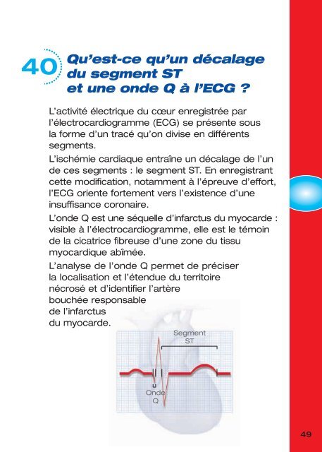 Maladie Coronaire et Infarctus Du Myocarde (IDM) - PrÃ©vention des ...