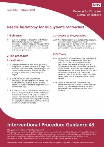 IPG043 Needle fasciotomy for Dupuyren's contracture - guidance