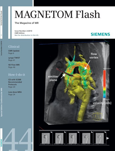 MAGNETOM Flash, CMR Issue, No. 44 12.5MB - Siemens Healthcare