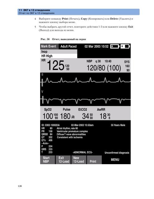 Ð¼Ð¾Ð½Ð¸ÑÐ¾ÑÐ° Philips HeartStart MRx M3535a Ð¸ M3536a