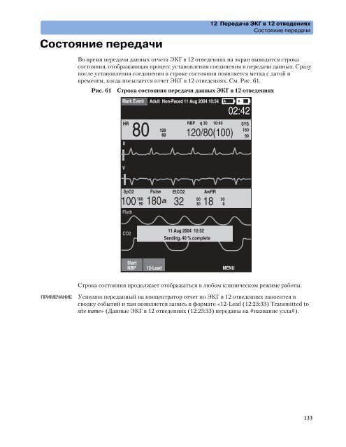 Ð¼Ð¾Ð½Ð¸ÑÐ¾ÑÐ° Philips HeartStart MRx M3535a Ð¸ M3536a