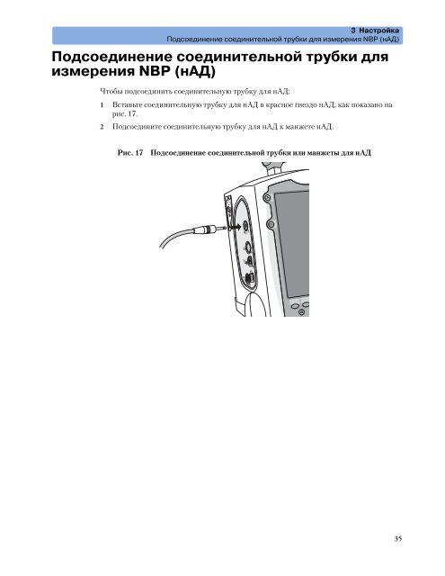 Ð¼Ð¾Ð½Ð¸ÑÐ¾ÑÐ° Philips HeartStart MRx M3535a Ð¸ M3536a