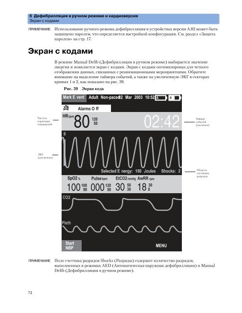 Ð¼Ð¾Ð½Ð¸ÑÐ¾ÑÐ° Philips HeartStart MRx M3535a Ð¸ M3536a