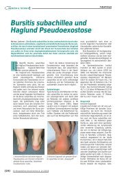 Bursitis subachillea und Haglund Pseudoexostose