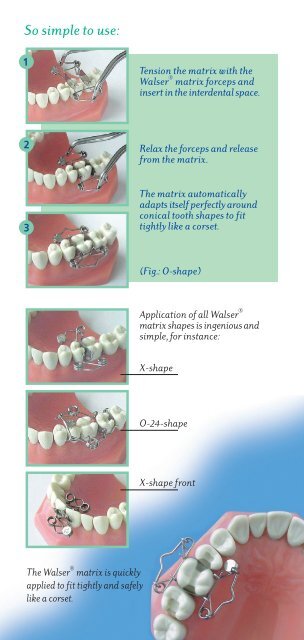 Walser Matrices - Janouch Dental