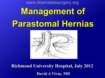 Parastomal Hernia
