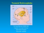 Neonatal Hydrocephalus - International Hydrocephalus Imaging ...