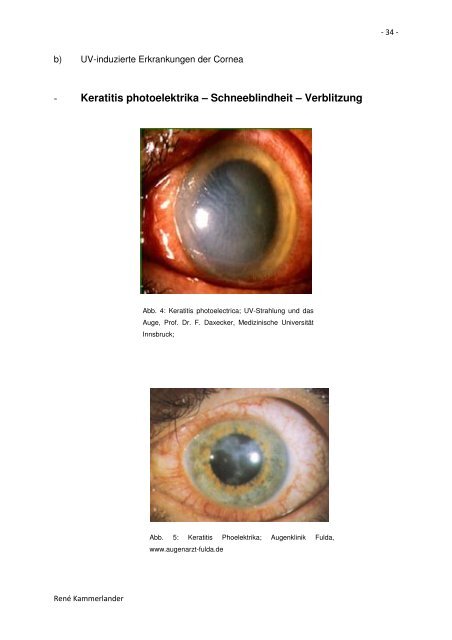 UV-Strahlung - Private HTL des Landes Tirol - Kolleg für Optometrie