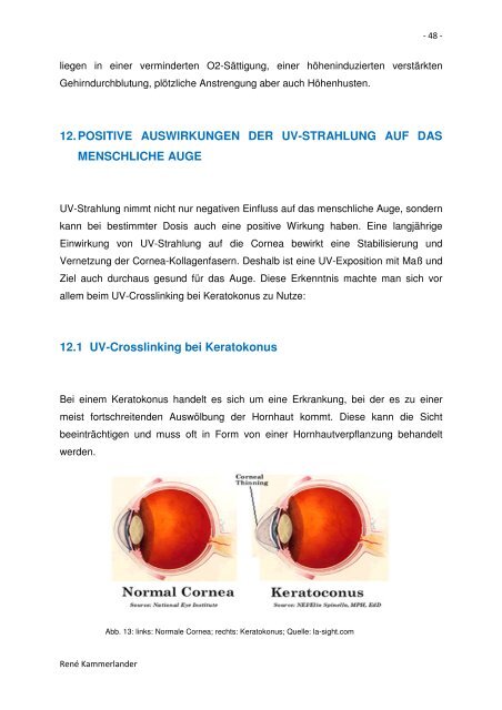 UV-Strahlung - Private HTL des Landes Tirol - Kolleg für Optometrie