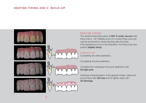 instructions for use creation classic gingiva ceramics - Jensen Dental