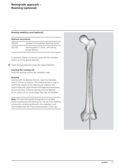 Expert R/AFN Retrograde /Antegrade Femoral Nail. - Osteosyntese