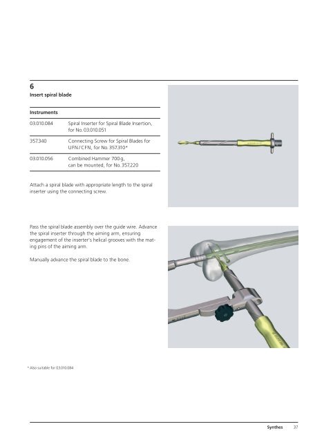 Expert R/AFN Retrograde /Antegrade Femoral Nail. - Osteosyntese