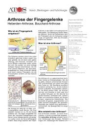 Arthrose der Fingergelenke - und Fußchirurgie